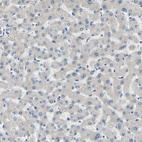 Immunohistochemical staining of human liver shows no positivity in hepatocytes as expected.