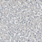 Immunohistochemical staining of human liver shows no positivity in hepatocytes as expected.