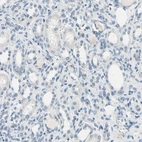 Immunohistochemical staining of human kidney shows no positivity in cells in tubules as expected.