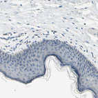 Immunohistochemical staining of human skin shows no positivity in squamous epithelial cells as expected.