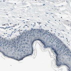 Immunohistochemical staining of human skin shows no positivity in squamous epithelial cells as expected.