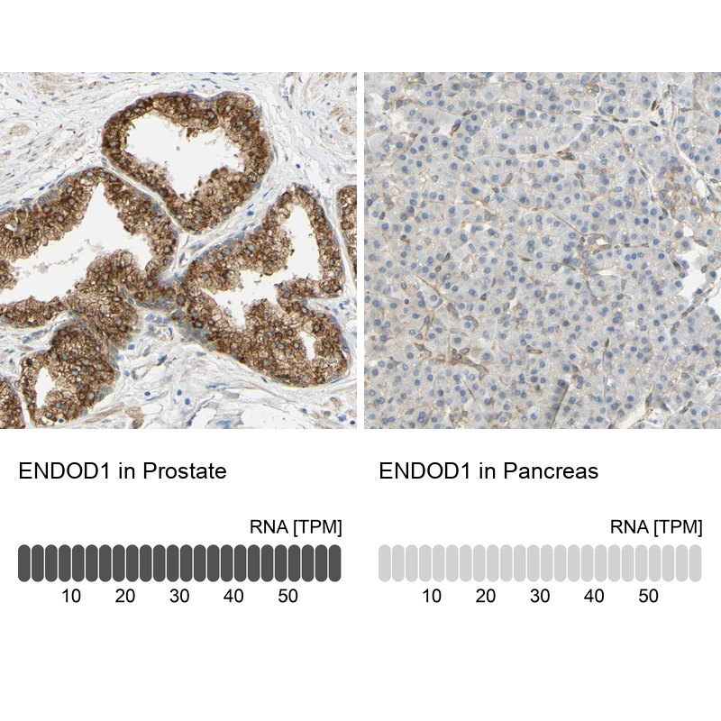 Anti-ENDOD1 Antibody
