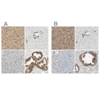 Immunohistochemical staining of human cerebral cortex, liver, pancreas and prostate using Anti-ENDOD1 antibody HPA008932 (A) shows similar protein distribution across tissues to independent antibody HPA010517 (B).
