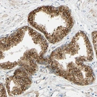 Immunohistochemical staining of human prostate shows moderate to strong cytoplasmic positivity in glandular cells.