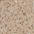 Immunohistochemical staining of human cerebral cortex shows strong cytoplasmic positivity in glial cells.