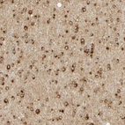 Immunohistochemical staining of human cerebral cortex shows strong cytoplasmic positivity in glial cells.