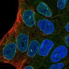 Immunofluorescent staining of human cell line RT4 shows localization to nucleoplasm & nuclear membrane.