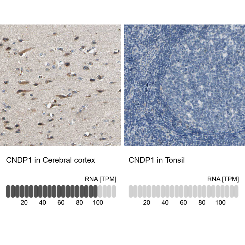 Anti-CNDP1 Antibody