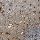 Immunohistochemical staining of human cerebellum shows strong cytoplasmic positivity in molecular layer.