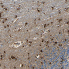 Anti-CNDP1 Antibody