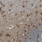 Immunohistochemical staining of human cerebellum shows strong cytoplasmic positivity in molecular layer.