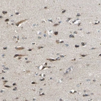 Immunohistochemical staining of human cerebral cortex shows strong cytoplasmic positivity in neurons.