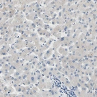 Immunohistochemical staining of human liver shows no cytoplasmic positivity in hepatocytes.