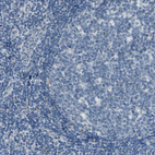 Anti-CNDP1 Antibody