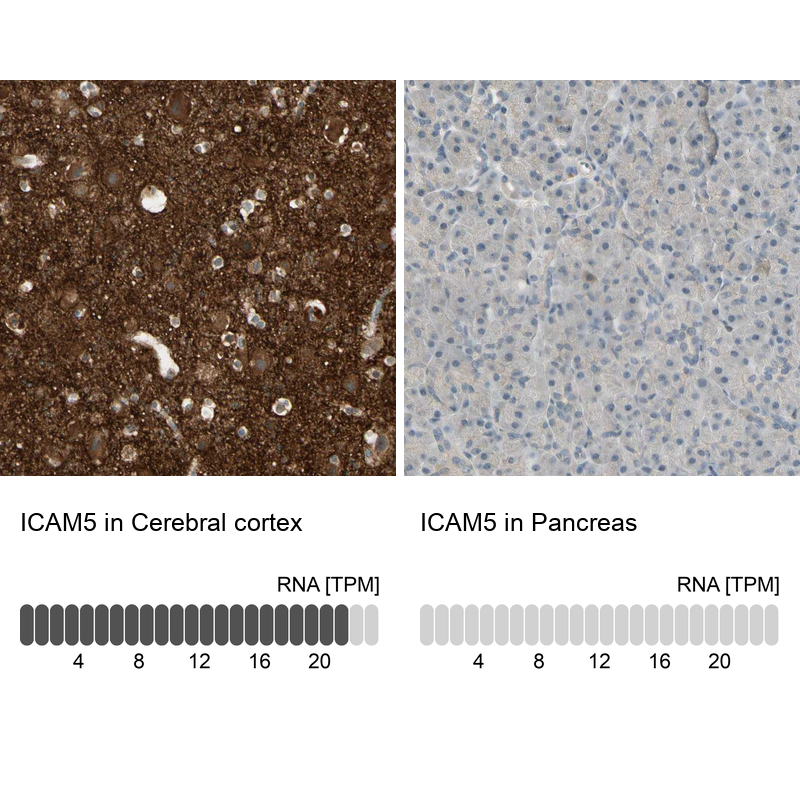 Anti-ICAM5 Antibody