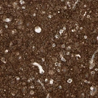 Immunohistochemical staining of human cerebral cortex shows high expression.