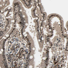 Immunohistochemical staining of human duodenum shows moderate to strong nuclear positivity in glandular cells.