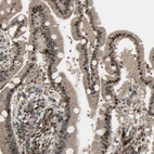 Immunohistochemical staining of human duodenum shows moderate to strong nuclear positivity in glandular cells.