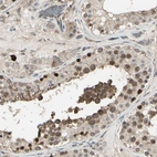 Immunohistochemical staining of human testis shows moderate to strong cytoplasmic and nuclear positivity in cells in seminiferous ducts.