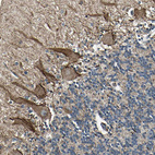 Immunohistochemical staining of human cerebellum shows strong positivity in neuronal processes.