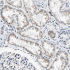 Immunohistochemical staining of human kidney shows moderate cytoplasm granular positivity in cells in tubules.