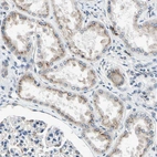 Immunohistochemical staining of human kidney shows moderate cytoplasm granular positivity in cells in tubules.