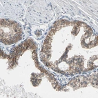 Immunohistochemical staining of human prostate shows strong membranous positivity in glandular cells.