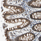 Immunohistochemical staining of human rectum shows strong cytoplasmic positivity in glandular cells.