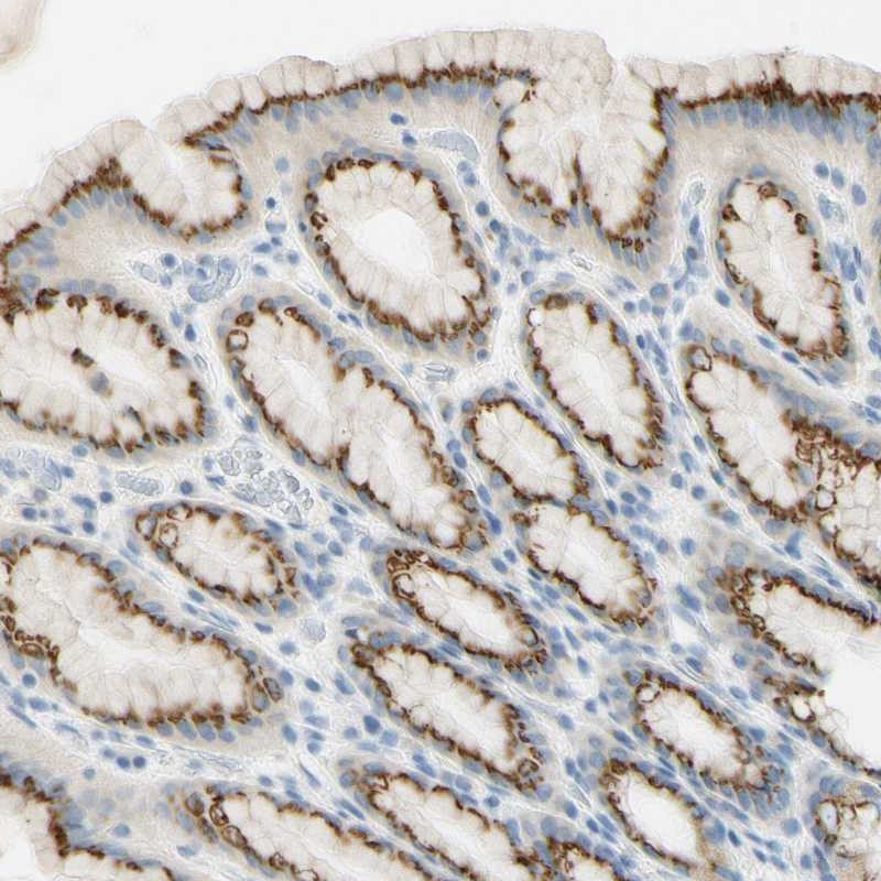 Anti-GALNT5 Antibody