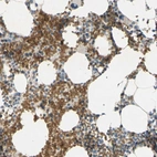 Immunohistochemical staining of human bone marrow shows strong membranous positivity in erythrocytes.