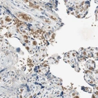 Immunohistochemical staining of human placenta shows strong membranous positivity in erythrocytes.