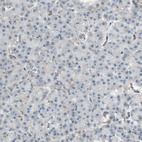 Immunohistochemical staining of human pancreas shows no positivity in exocrine glandular cells as expected.