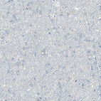 Immunohistochemical staining of human cerebral cortex shows no positivity in neurons as expected.