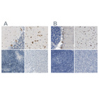 Anti-B4GALNT1 Antibody