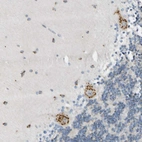 Immunohistochemical staining of human cerebellum shows strong granular cytoplasmic positivity in Purkinje cells.