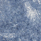 Immunohistochemical staining of human lymph node shows no positivity in germinal center cells as expected.
