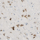 Immunohistochemical staining of human cerebral cortex shows strong granular cytoplasmic positivity in neurons.