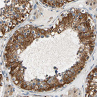 Immunohistochemical staining of human testis shows strong membranous positivity in cells in seminiferous ducts.