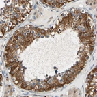 Immunohistochemical staining of human testis shows strong membranous positivity in cells in seminiferous ducts.