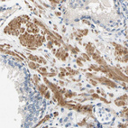 Anti-SLC27A6 Antibody