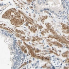 Immunohistochemical staining of human prostate shows moderate cytoplasmic positivity in smooth muscle cells.