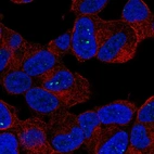 Immunofluorescent staining of human cell line SH-SY5Y shows localization to nuclear bodies.