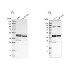 Western blot analysis using Anti-CFAP36 antibody HPA008994 (A) shows similar pattern to independent antibody HPA017061 (B).