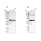 Western blot analysis using Anti-CFAP36 antibody HPA008994 (A) shows similar pattern to independent antibody HPA017061 (B).