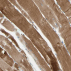 Immunohistochemical staining of human skeletal muscle shows strong cytoplasmic positivity in myocytes.