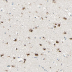 Anti-JPH1 Antibody