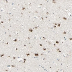 Immunohistochemical staining of human cerebral cortex shows strong cytoplasmic positivity in neuronal cells.