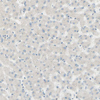 Anti-JPH1 Antibody