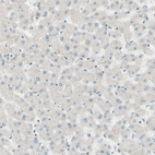 Immunohistochemical staining of human liver shows no positivity in hepatocytes as expected.