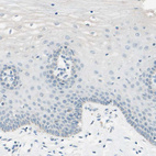 Anti-JPH1 Antibody